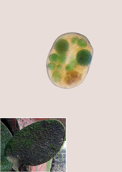 Ciliate protozoa Ciliophora Folliculinidae Vorticellidae Images UK