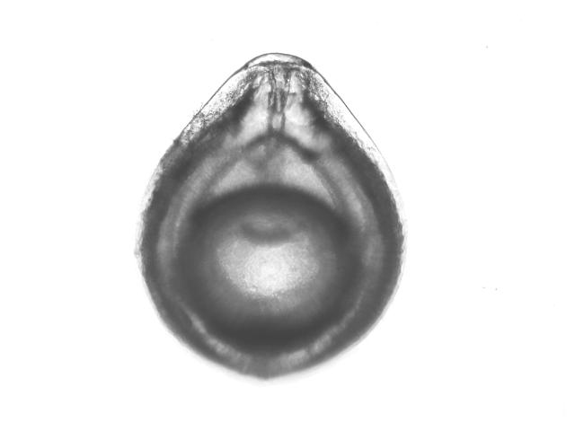 Fissurina orbignyana Ellipsolagenidae Ellipsolagenid Foram Foraminifera Images