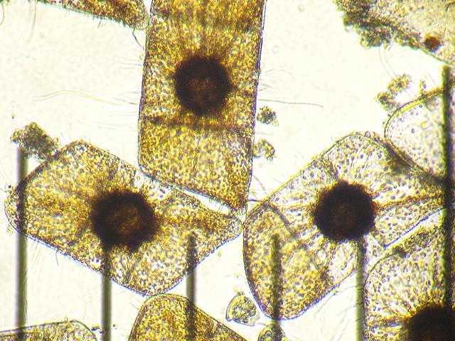 Isthmia nervosa Diatom Microalgae images