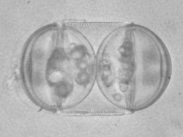 Podosira stelligera Diatom Microalgae images