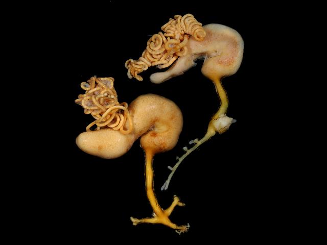 Lernaeocera branchialis cod worm parasitic sea louse copepod images
