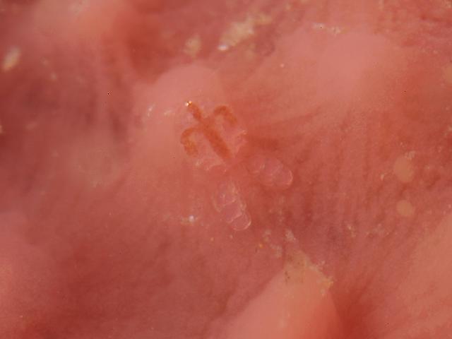 Asterocheres species sponge Aplysilla rosea Copepod Images