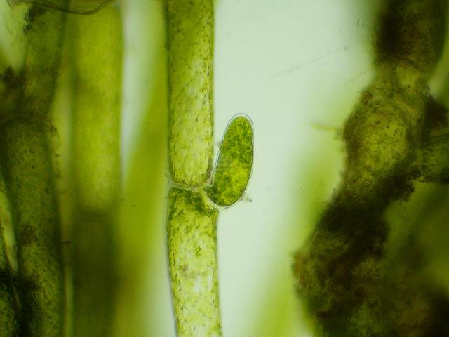 Кладофора хвощ полевой редька дикая среда обитания. Кладофора водоросль клетки. Кладофора Стимпсона. Кладофора водоросль под микроскопом. Кладофора шаровидная под микроскопом.