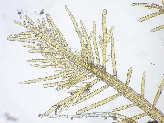 Desmarestia species microscopic juvenile brown seaweed images
